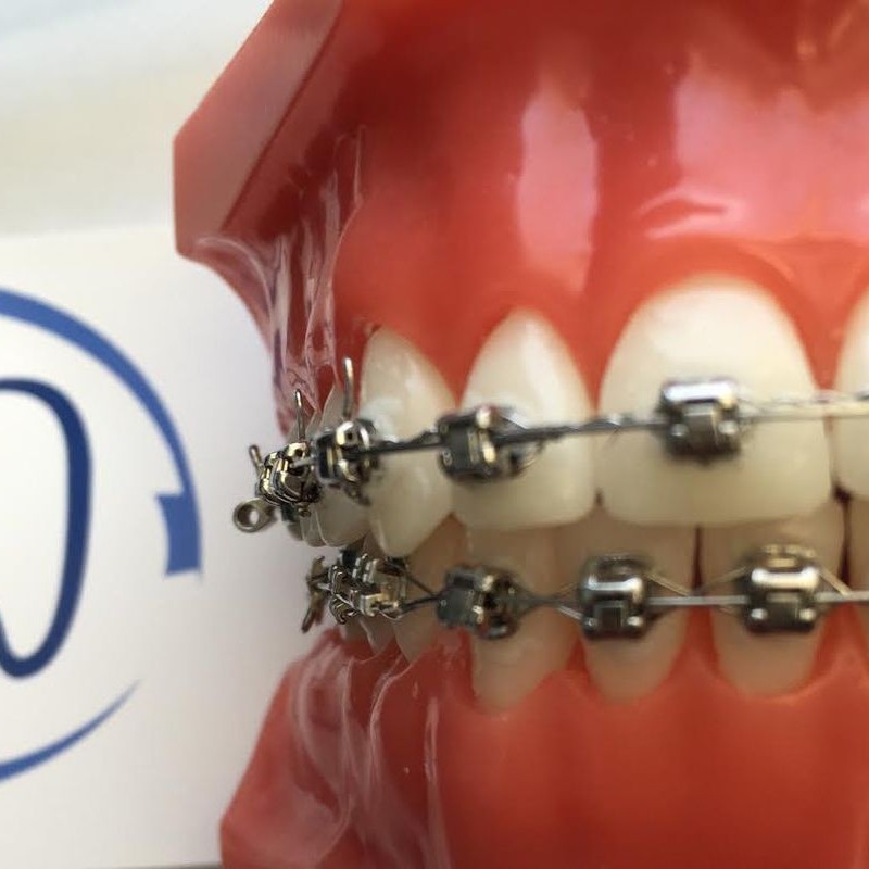 Berango Dental, ortodoncia